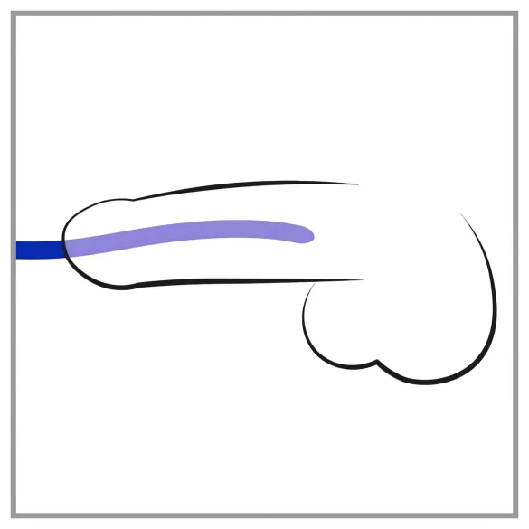 You2Toys - dilator set - siliconen penispluggen set van 3